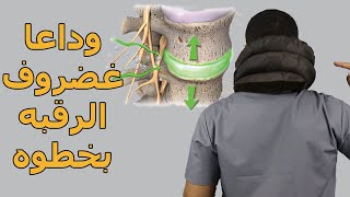 وداعا انزلاق غضروف الرقبة وتنميل وكهربة الايد بدون جراحة/جهاز شد فقرات الرقبة بنفسك ف البيت