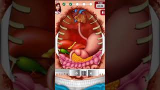 Doctor Surgery Game //Heart Surgery//android gameplay screenshot 5