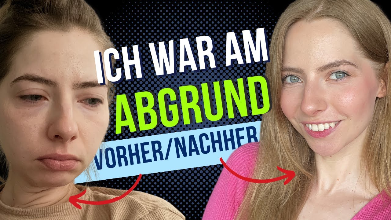 Ketogene Ernährung bei MIGRÄNE mit Aura. Erfahrungsbericht nach 1 Jahr und 8 Monaten Keto Diät.