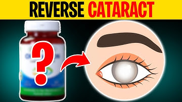 How to Prevent Cataracts From Getting Worse - 6 Tips to Reverse Damage