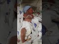 Недоношеный малыш 32 недели