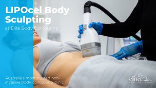 LIPOcel Body Sculpting at Elite Body Contouring