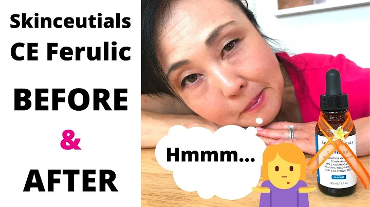 SkinceuticalsCE Ferulic Worth it?  Before and After