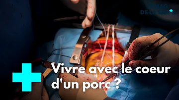 Première mondiale : un cœur de porc greffé à un homme - Le Magazine de la Santé