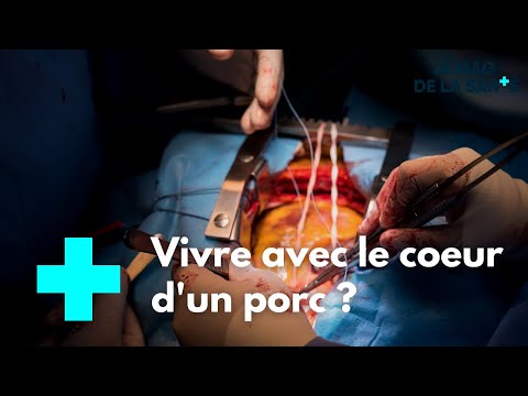 Vidéo: Pourquoi la transplantation est-elle meilleure que la diffusion ?