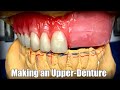 Making an Upper-Denture