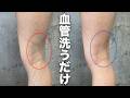 【血管を洗うだけで血流が爆増】坐骨神経痛とお尻の奥の痛みが消えていく。