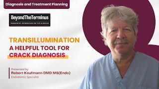 Transillumination – a Helpful Tool for Crack Diagnosis | Robert Kaufmann DMD MS(Endo)