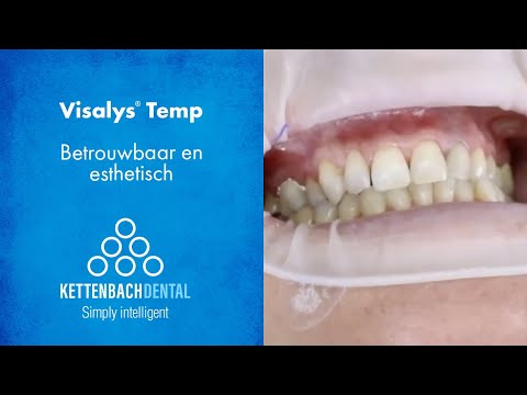 Visalys® Temp - Betrouwbaar en Esthetisch
