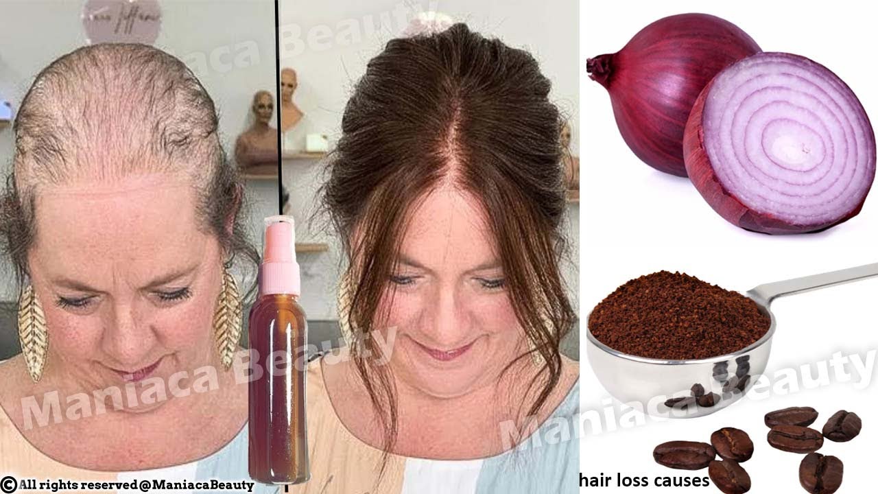 i tried Hair loss natural treatment ,my hair Regrow naturally in 3