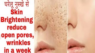 चहरे से गड्ढे,खुले रोमछिद्रों,wrinkles को घरेलू नुस्खे से हटाएwithin a week 70%open pores reduce करे