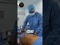 Is Liposuction Safe or Traumatic? The Truth You Need to Know | Dr. Gautam Chaudhury