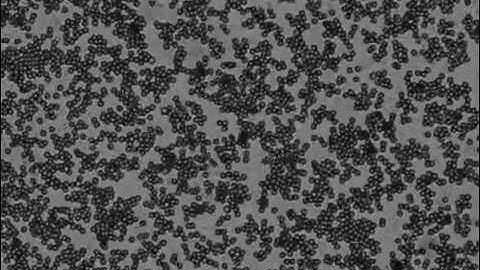 Solution of "Janus" particles under an AC electric field of 80 kHz