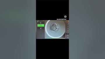 AI in the IVF laboratory #embryologist #fertilitytreatment #science  #ivf #artificialintelligence