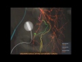 Mentice Prostatic Artery Embolization (PAE) Training Software