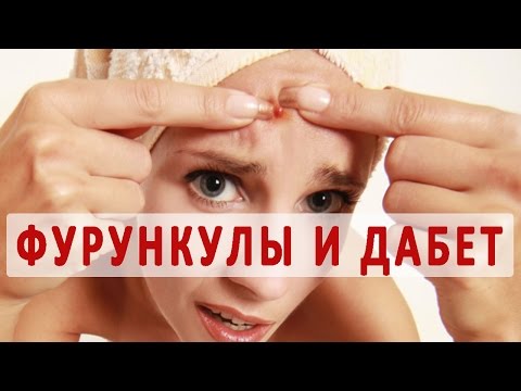 Видео: Диабетические фурункулы: вызывает ли диабет фурункулы?