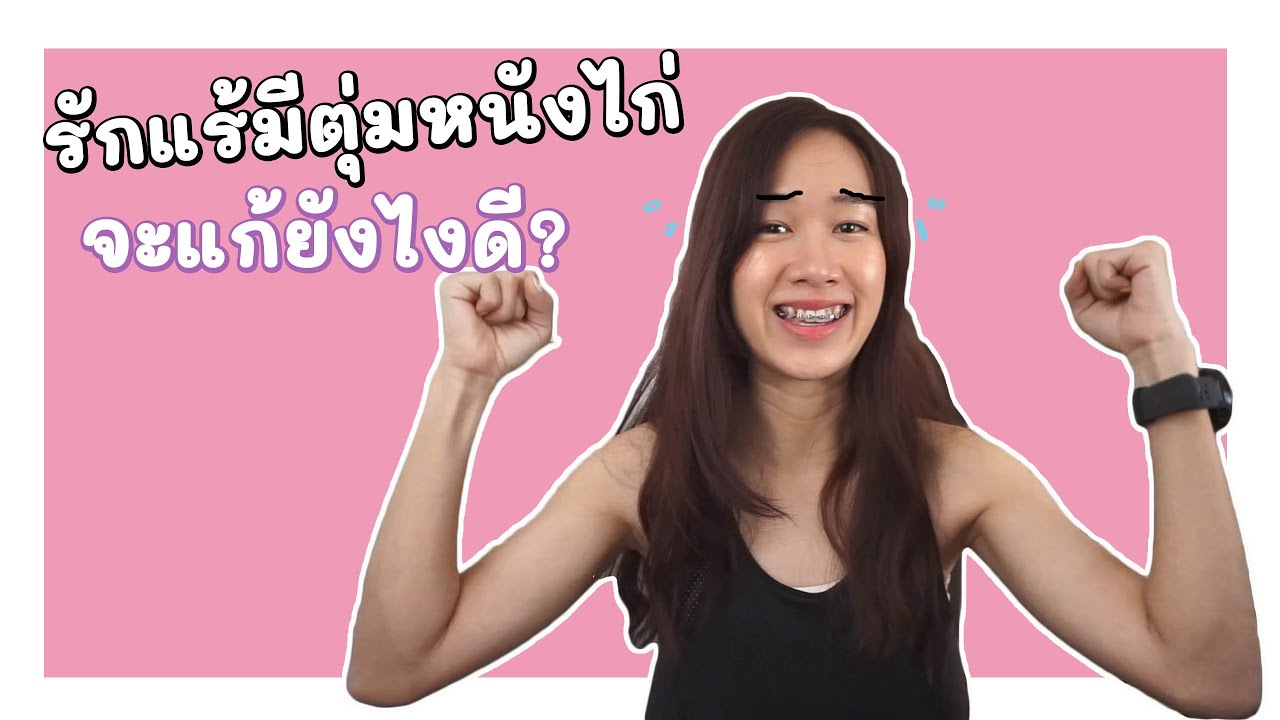 รักแร้เป็นหนังไก่  Update  ไม่กล้าโชว์วงแขน รักแร้มีตุ่มหนังไก่ จะแก้ยังไงดี ?? | Archiiอาชิ