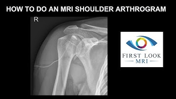 HOW TO DO A SHOULDER ARTHROGRAM