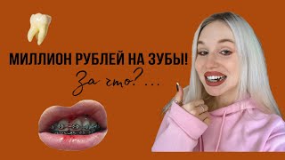 Про брекеты, операции и миллион 🍋 на лечение…