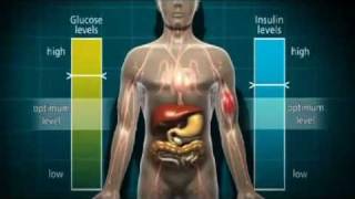Animation about diabetes and the body