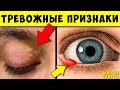 Серьёзные признаки Опасных заболеваний по Глазам! Не Игнорируй их...