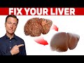 The 6 Best Ways to Heal a Fatty Liver