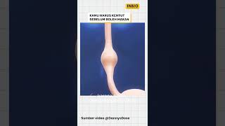 Download Lagu Kamu harus kentut sebelum boleh makan MP3