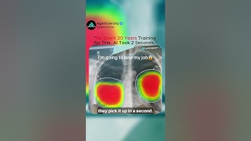 “AI Outsmarts Radiologists? The Truth Behind the X-Ray Revolution!”