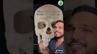 Tooth Decay Treatment For A Tooth Cavity