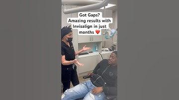 Got Gaps? Amazing Invisalign results in just months ❤️