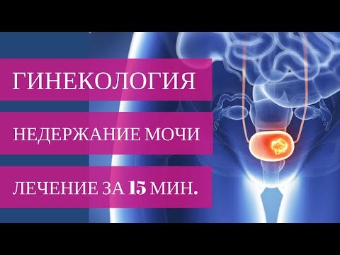 ЭФФЕКТИВНОЕ ЛЕЧЕНИЕ стрессового недержания мочи ЗА 15 МИНУТ. Система TVT-O!