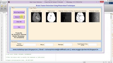 Matlab Code for Brain Tumor Detection Using Watershed Technique