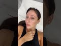 Getting an enzyme peel and led facial  carly musleh shorts