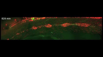 Zebrafish lateral line migration: One direction