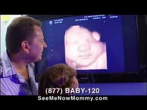 3d Ultrasound Hesperia Ca