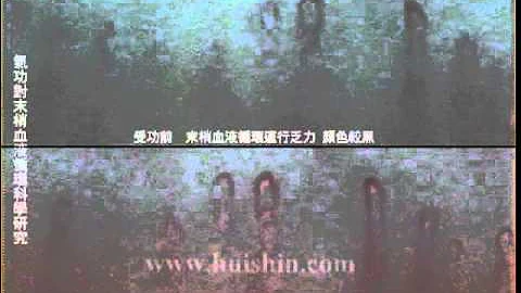 气功对微循环科学研究 - 天天要闻