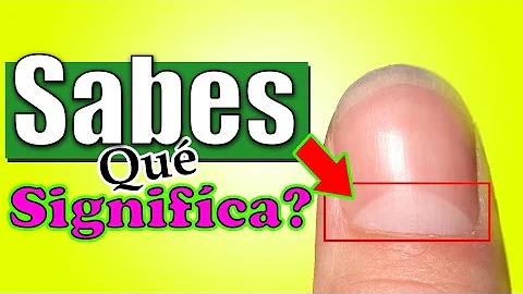 ¿Qué significan las uñas blancas para un hombre?