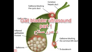 Abdominal U/S course : lecture 7a ( Gall bladder ultrasound) د عمرو صلاح