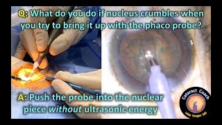 Embed the phaco probe in the nucleus without ultrasound in Cataract Surgery