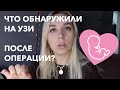 Год спустя. Лапароскопическая операция на яичнике. Последствия.