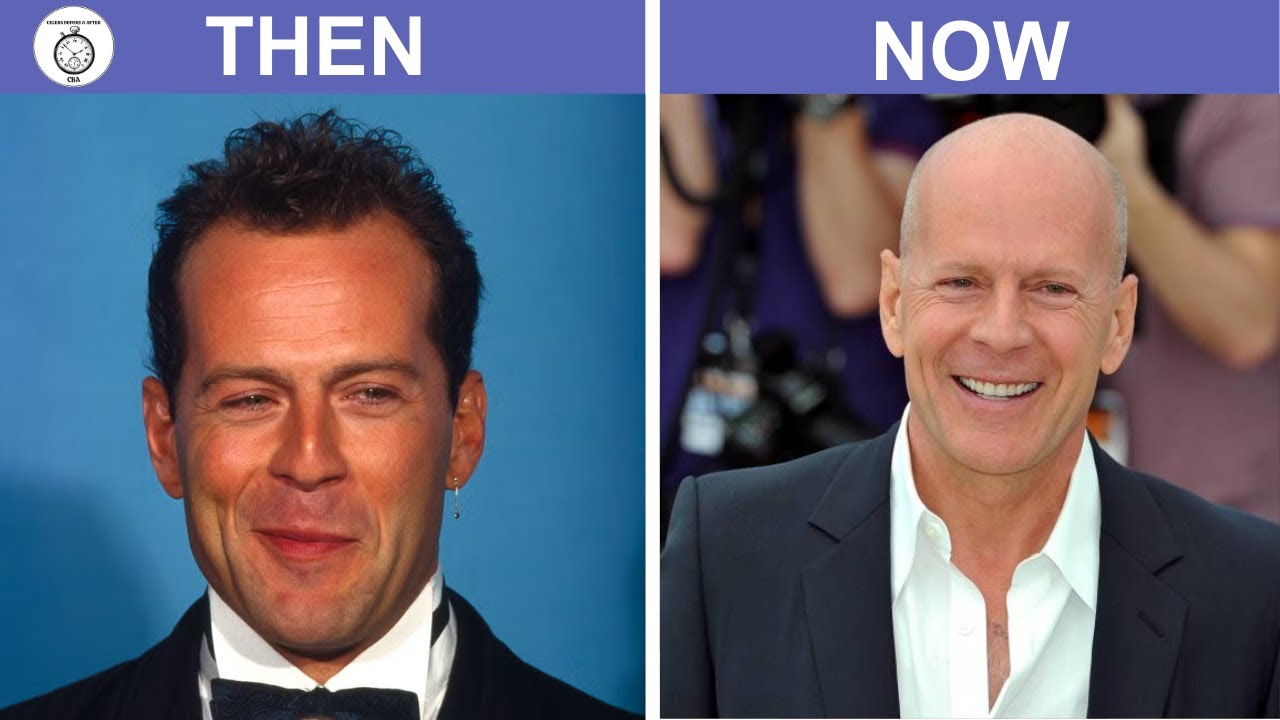 The Tragic Real-Life Story of Bruce Willis 2026 - YouTube