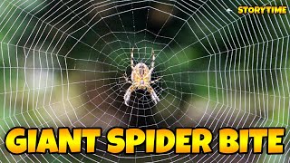 I Got A Spider Bite... (Storytime) screenshot 4