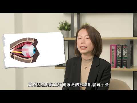 影片縮圖:眼瞼下垂及眼瞼腫塊:常見眼瞼疾病解析