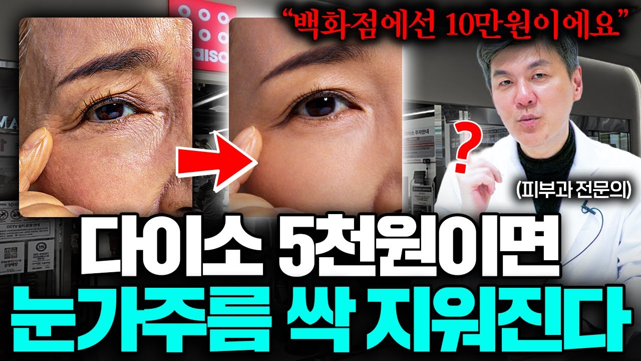 자글자글한 눈가 주름은 '여기'를 누르면 쫙쫙 펴집니다 (성현철 원장 1부)