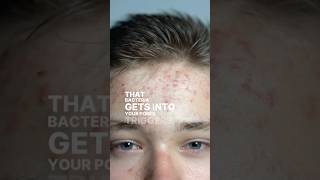 You touch your face 23 times an hour — here's what it's doing to your skin