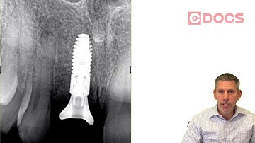 Tip of the Day: Axeos