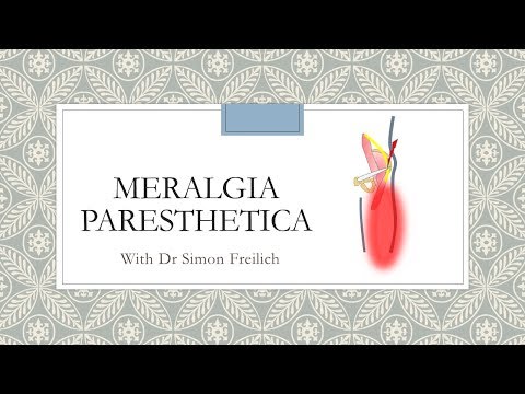 Video: Meralgia Paresthetica-øvelser: Trinnvis Guide For Smertelindring