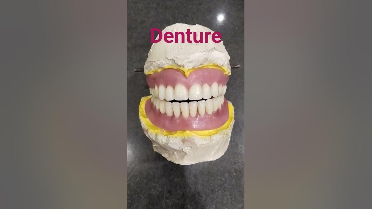 Upper and Lower Complete Denture Setup By Haider..dentalartbyhaider 