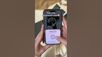 First look at our little miracle 🌟👶 #babyreveal #nfccase #shorts