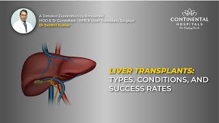 Liver Transplants: Types, Conditions, and Success Rates | Dr. Senthil #livertransplant